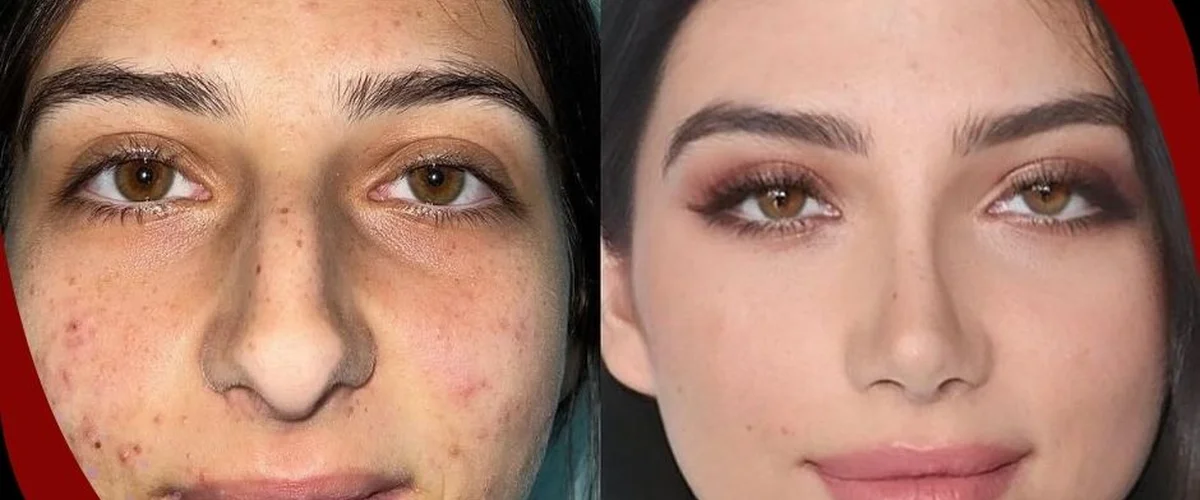 عيادة التجميل الوجهي والفكي - ريف دمشق
