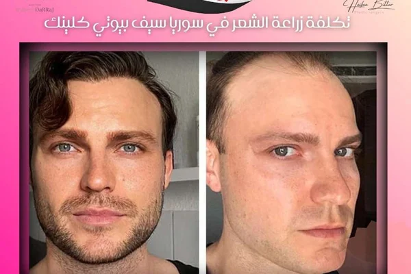 Tsharm Bywty Klynk